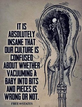 fTKvchCl[1].jpg